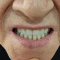 دندانسازی (ساخت دندان مصنوعی تعمیر دندان مصنوعی )|خدمات آرایشگری و زیبایی|تهران, مشیریه|دیوار