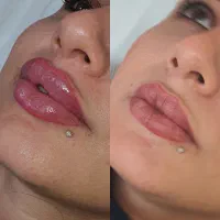 مرکز فوق تخصصی لیفت نخ ژل بوتاکس جراحی های زیبایی