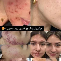 جوانسازی پوست