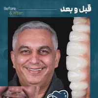 دندانپزشکی/ مرکز ایمپلنت دیجیتال 6800|خدمات آرایشگری و زیبایی|تهران, پاسداران|دیوار