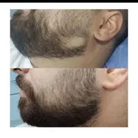ریش تراش بدون ریش چه فایده