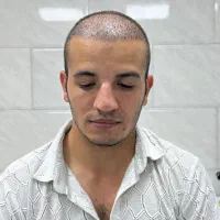 کاشت مو و ابرو با شرایط تابستانه