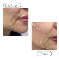 تزریق ژل و بوتاکس، ژل لب روسی و آموزش و ارائه مدرک|خدمات آرایشگری و زیبایی|کرج, شاهین‌ویلا|دیوار