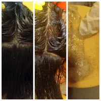 خارج کردن شپش سر