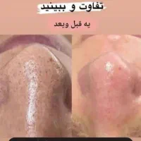 محصولات مراقبتی پوست و مو و سلامت بدن|آرایشی، بهداشتی، درمانی|خوی, |دیوار