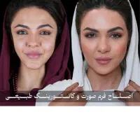 بوتاکس پیشانی و خط اخم رایگان شد روز یکشنبه