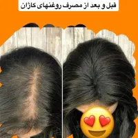 روغن تراپی|آرایشی، بهداشتی، درمانی|اهواز, عامری|دیوار