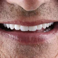 دندانسازی (دندان مصنوعی)|خدمات آرایشگری و زیبایی|اصفهان, وحید|دیوار