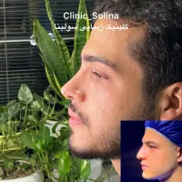 عمل زیبایی بینی و پلک