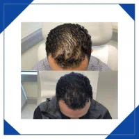 موهات رو دقیقا شبیه آب خوردن درش بیار