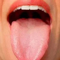 تشخیص بیماری ها از روی زبان و درمان به صورت سنتی