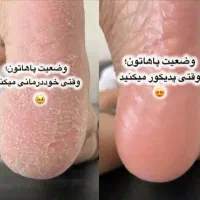 پدیکور و کفسابی پارافین تراپی