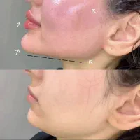 ژل ،بوتاکس، کوچک کردن بینی ،جوانسازی در کیلینیک|خدمات آرایشگری و زیبایی|کرمانشاه, |دیوار