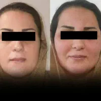 پودر جوانه گندم بین استار چاقی صورت100%تضمینی|خوردنی و آشامیدنی|اهواز, سپیدار|دیوار