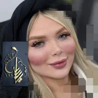 تزریق ژل وبوتاکس ومادلینگ اروپایی وهایفو درکلینیک