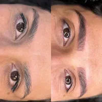 فرصت ویژه مدل میکروبلیدینگ