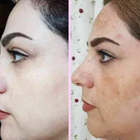 کرم معجزه اصلی تضمینی جوابدهی سریع|آرایشی، بهداشتی، درمانی|شیراز, کوشک میدان|دیوار