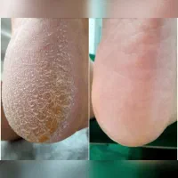 پدیکور و کفسابی تخصصی