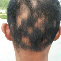 کاشت ممنوع