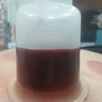 .الحجامه . حجامت وبادکش.  ادرس چومه سید علوان
