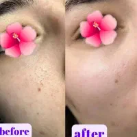 فیشیال تخصصی با ده سال سابقه کاری