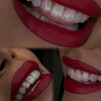دندانپزشکی اقساطی عصب کشی . کامپوزیت و...|خدمات آرایشگری و زیبایی|قم, عمار یاسر|دیوار