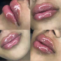 خدمات زیبایی فیلرلب وپیرسینگ