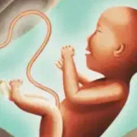 درمان ناباروری