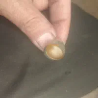 انگشتر کهنه قدیمی