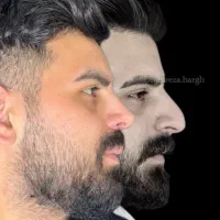 عمل جراحی بینی با ۵۰درصد تخفیف|خدمات زیبایی و سلامت|تهران, نظامی گنجوی (توانیر)|دیوار