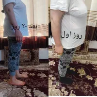 لاغری با طب سنتی