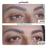 خدمات زیبایی اقساطی کلینیک دکتر خجسته|خدمات آرایشگری و زیبایی|گلبهار, شهر جدید گلبهار|دیوار