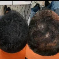 جشنواره مطب زیبایی ماهورا|خدمات آرایشگری و زیبایی|قروه, |دیوار