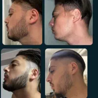 محصول ارگانیک صدرصدی رویش ریش