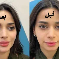 شما برندترین کلینیک زیبایی درایران را پیدا کردید|خدمات آرایشگری و زیبایی|کاشان, میدان کهنه|دیوار