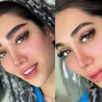 فیلر لیفت بینی و صورت وشقیقه مزوتراپی بوتاکس|خدمات آرایشگری و زیبایی|تهران, تهرانپارس جنوبی|دیوار