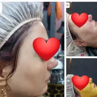 فشیال و خدمات جوانسازی ارغوان در..شهرک نور|خدمات آرایشگری و زیبایی|نیشابور, شهرک ولیعصر|دیوار