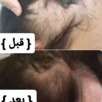 تونیک ضدریزش و رویش مجدد هیرفرند|آرایشی، بهداشتی، درمانی|تهران, نیروی هوایی (پیروزی)|دیوار