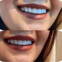 دندانپزشکی اقساطی با وام قرض الحسنه|خدمات آرایشگری و زیبایی|اصفهان, لاله|دیوار