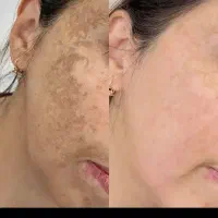 تخفیفات ۲۰ درصدی پی ارپی سابسیژن اموزش پی ارپی
