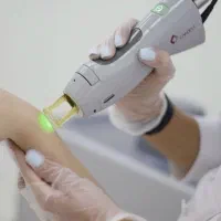 نیازمند اپراتور لیزر