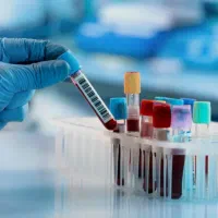 استخدام نیروی علوم آزمایشگاهی