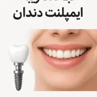 فقط با ۱۴ میلیون بهترین ایمپلنت انجام بده