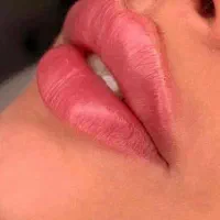 ژل،بوتاکس،لیزر،پی ارپی