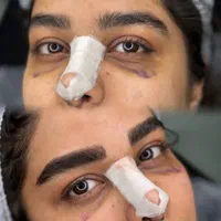 آموزش و خدمات تخصصی آرایش دائم و میکروبلیدینگ|خدمات آرایشگری و زیبایی|اصفهان, خواجو|دیوار