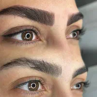 میکروبلیدینگ فیبروز شیدینگ لب بن مژه