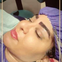 مدل کاشت مو و ابرو
