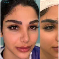 مدل کاشت ابرو