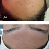 تبلیغ تابستانه فیشال و پاکسازی پوست