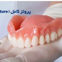 دست دندان کامل (دندان مصنوعی)